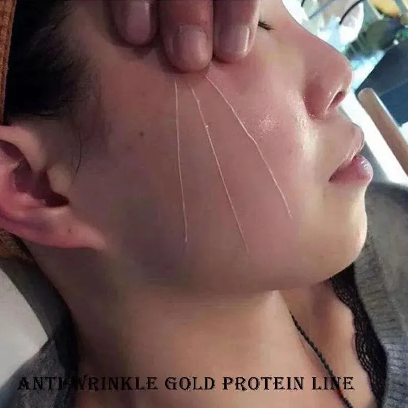 Instant Lifting Collagen Protein Thread Set for Wrinkle Removal, Facial Filler, Absorbable V Face Thread, Silk Firming for Anti-aging Care